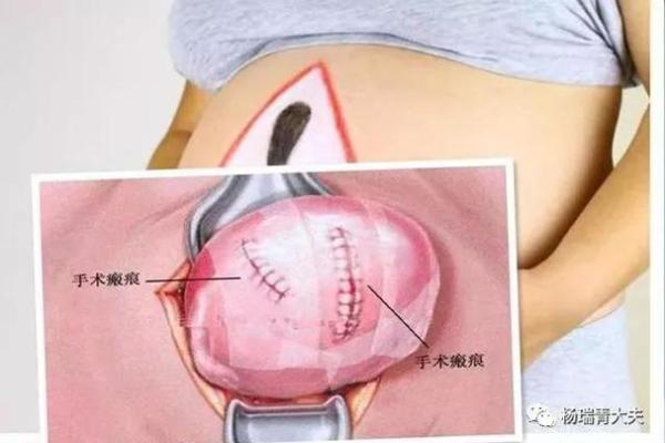 2025年11月剖腹产黄道吉日查询，哪几天最适合手术且母子平安？